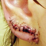O que os Piercings e Alargadores Podem Fazer com Você