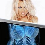 Diversas Imagens com Raio-X
