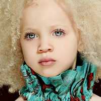 Conheça Ava Clarke, uma Linda Menina Negra com Albinismo