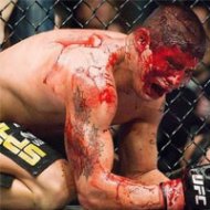 Fotos das Lutas Mais Sangrentas da MMA