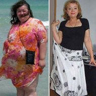 Mulher Perde 70 kg em 18 Meses