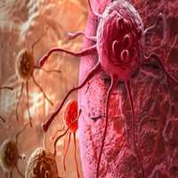 Novo Tratamento do Câncer Pára o Crescimento de Tumor