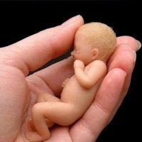 850 Mil Mulheres Realizam Aborto no Brasil Por Ano