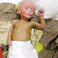 Bebê Morre Depois de Erros Médicos na China