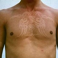 Tatuagem Solar: uma Moda Perigosa