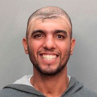 Polícia de Miami Prende Rapaz com Crânio Bizarro