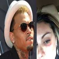 Brasileira Acusou o Rapper Americano Chris Brown de TÃª-la Agredido Fisicamente com um Soco em Seu R