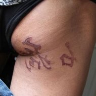 ChinÃªs Acorda com Tatuagem Misteriosa na Bunda ApÃ³s Cirurgia